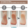 Electric Foot Callus Remover